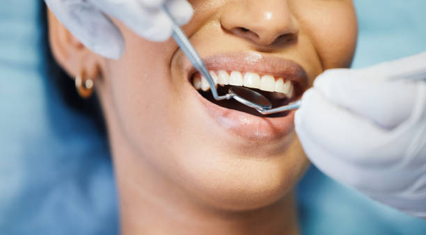 Best Emergency Dental Extractions in Raeford, NC